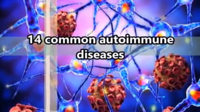 What are The Most Common Autoimmune Diseases